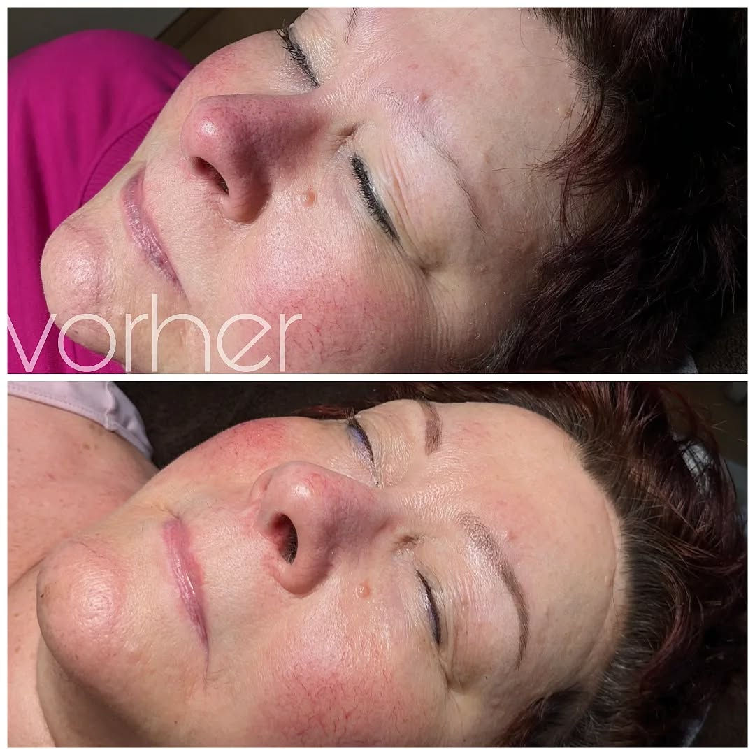 Vorher-Nachher einer Powderbrows-Behandlung